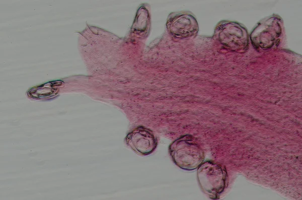 Parazit kanca küçük solucan — Stok fotoğraf