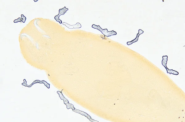 養殖魚の寄生虫 benedenia seriolae ワーム — ストック写真