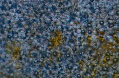 Kırmızı Kiraz kök test