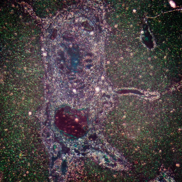 Mikrographie von Lebergewebe — Stockfoto