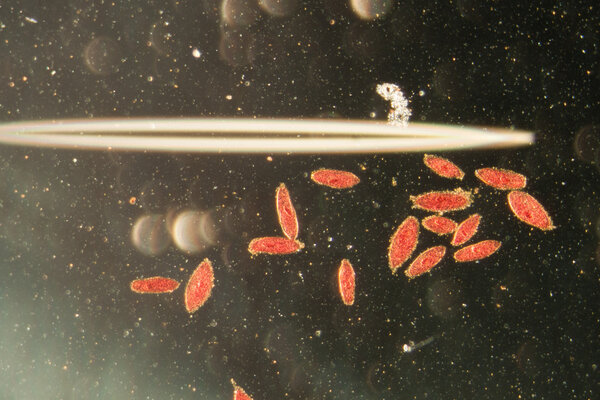 animal conjugation of Paramecium caudatum