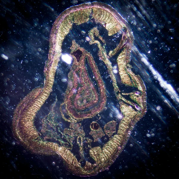 Micrografia minhocas corte transversal — Fotografia de Stock
