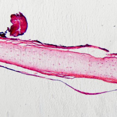kemik hücresi osteocyte