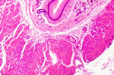 tabakalı Skuamöz epitel