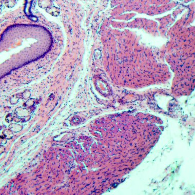 tabakalı Skuamöz epitel