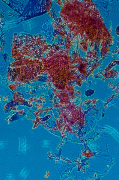 Μικρογραφία των εντόμων σώματος διατομή, σκώρο κάμπια — Φωτογραφία Αρχείου