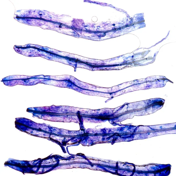 Науковий скляний мікроскоп ковзання з грибком всередині рослинної тканини s — стокове фото