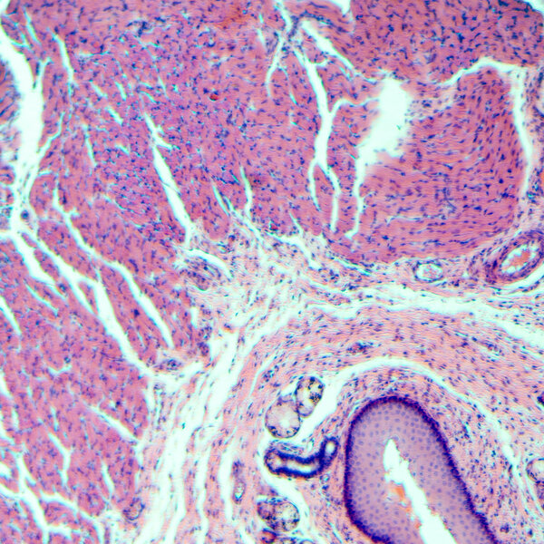 stratified squamous epithelium