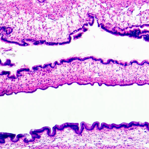 Tejido de epitelio ciliado — Foto de Stock