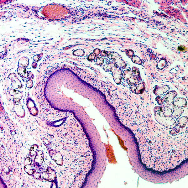 stratified squamous epithelium