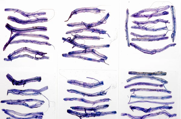 Ciencia vidrio microscopio diapositiva con hongo dentro de tejido vegetal s —  Fotos de Stock