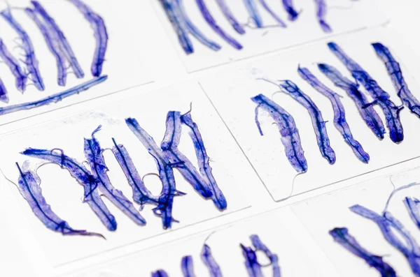 Wetenschap glas microscoopglaasje met schimmel binnen plant weefsel s — Stockfoto