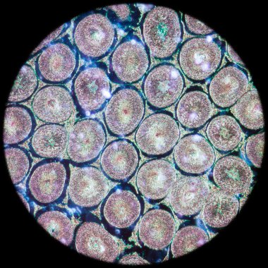 testis t.s doku mikroskobik bölümde