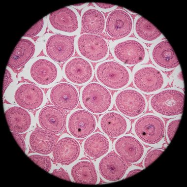 testis t.s doku mikroskobik bölümde