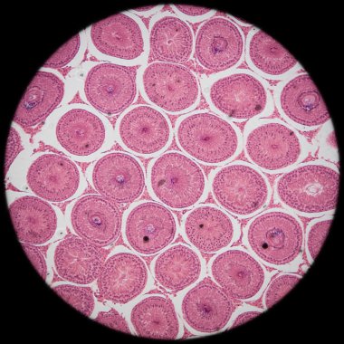 microscopic section of Testis T.S tissue clipart