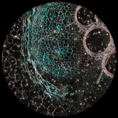 mikroskopi test bitki dokusu, kabak kök