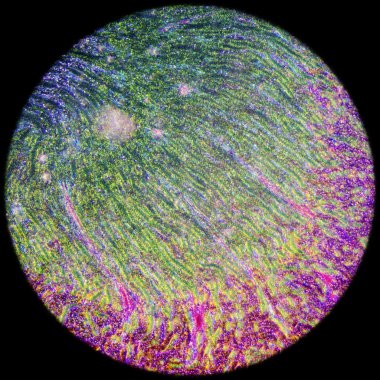 insan böbrek doku mikroskobik bölümde