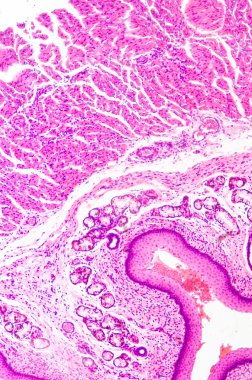 tabakalı Skuamöz epitel