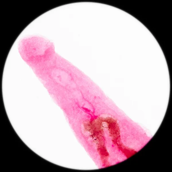 Tierische Parasiten schistosome Blutwürmer — Stockfoto