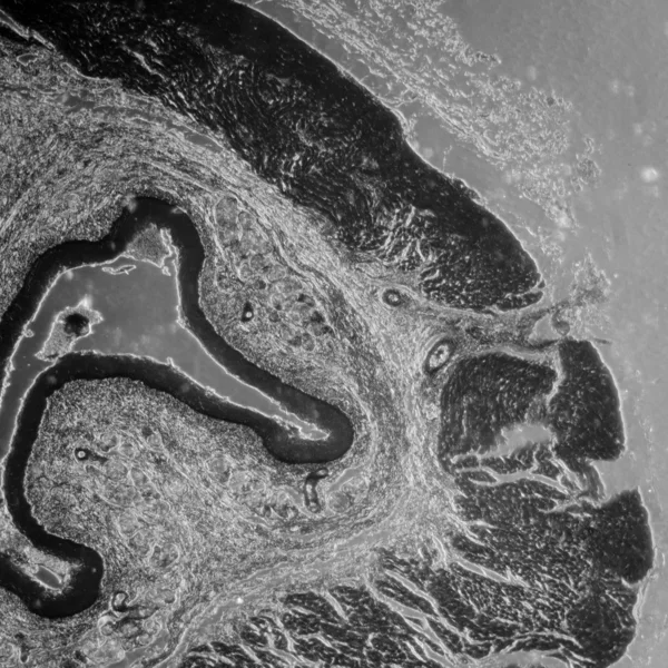 Epitelio escamoso estratificado — Foto de Stock