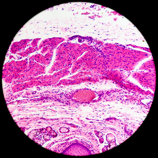 stratified squamous epithelium