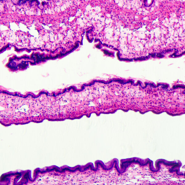 cilliated epithelium tissue
