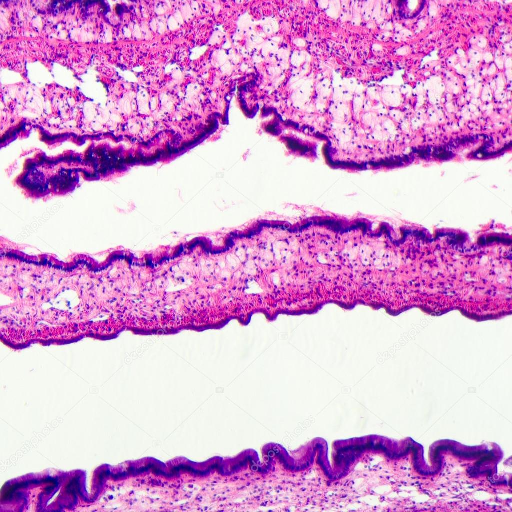 cilliated epithelium tissue