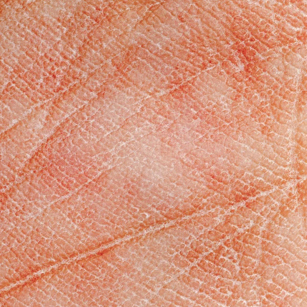 Dry skin texture — Stock Photo, Image