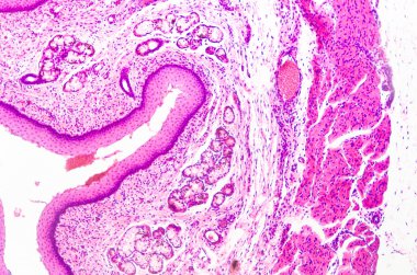 tabakalı Skuamöz epitel