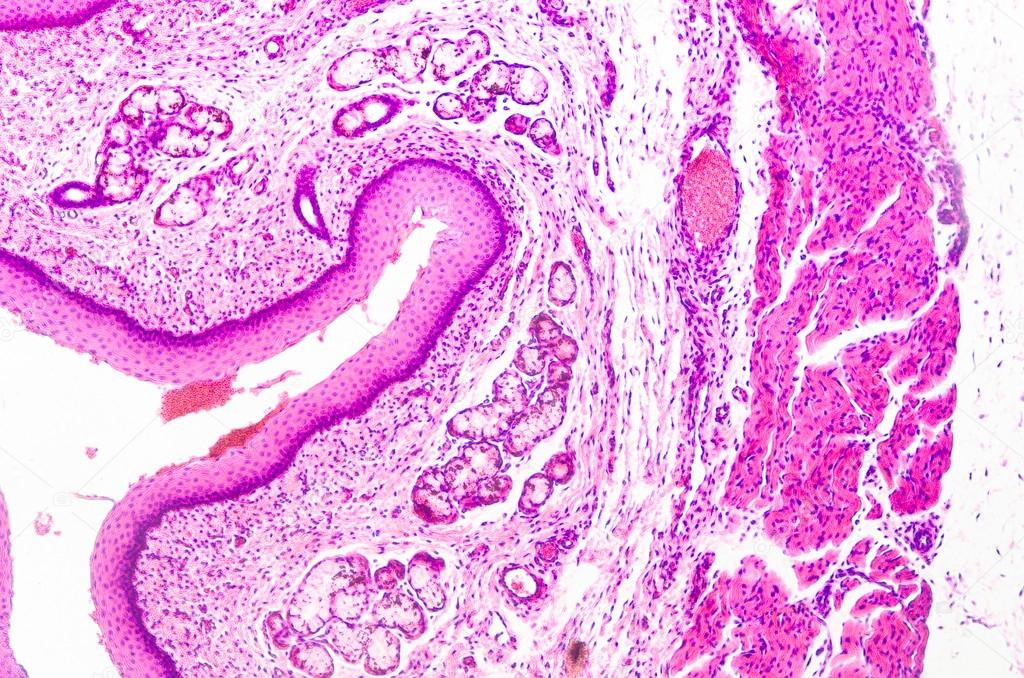 download download bladder biopsy interpretation 2003
