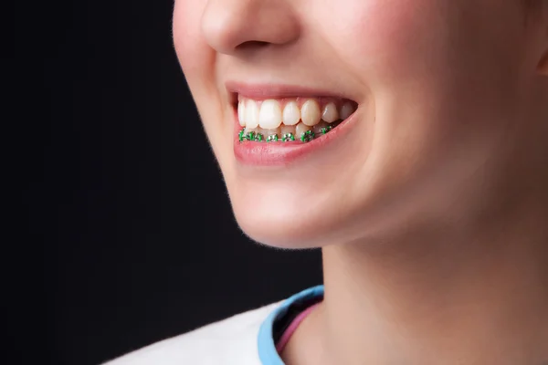 10 代の義歯 — ストック写真