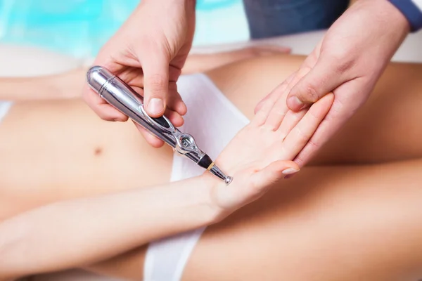 Laser acupuncture — Stock Photo, Image