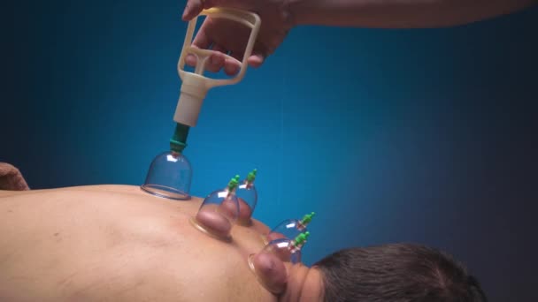 Prosedur pijat hampa udara. Kaleng hampa udara dipasang dengan tangan laki-laki. Close-up dari perawatan vaskular di permukaan belakang — Stok Video