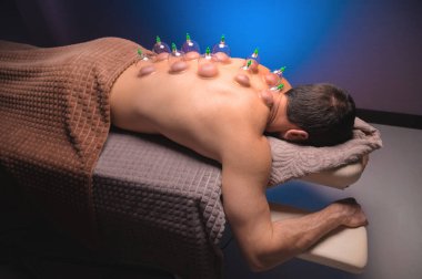 Adam vakumlu bardaklarla sağlığına kavuşuyor. Siyah-mavi arka plana karşı bir adamın sırtındaki vakumlu bardakları yakın plan. Geleneksel doğu tıbbı.