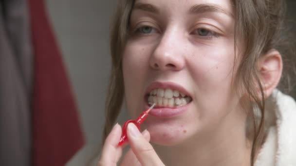 Biała kobieta używa szczoteczki międzyzębowej do czyszczenia przestrzeni międzyzębowej. Profesjonalna opieka doustna. Korekta ugryzienia zębów — Wideo stockowe