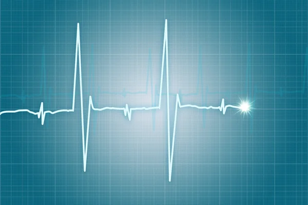 Hartslag cardiogram — Stockfoto