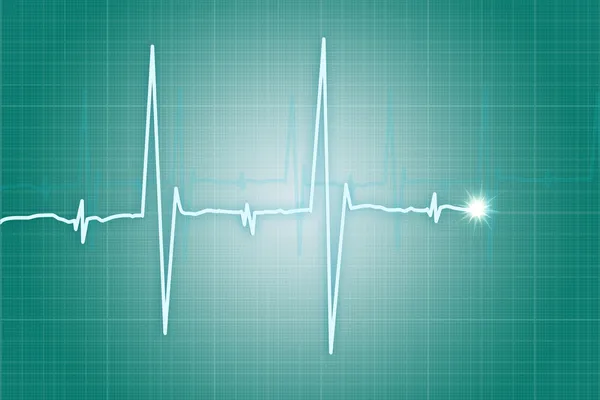 Cardiograma do batimento cardíaco — Fotografia de Stock