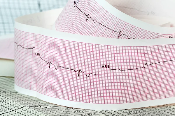 Cardiogram the concept for strokes and heart attacks — Stock Photo, Image