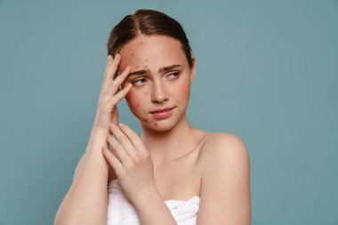 Sivilceli kızıl bir kadın yüzünü kapatıyor ve mavi arka planda tek başına bir kenara bakıyor.