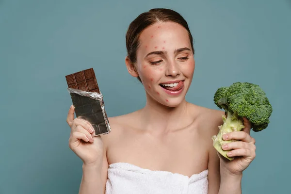 Mulher Gengibre Com Espinhas Posando Com Chocolate Brócolis Isolado Sobre — Fotografia de Stock