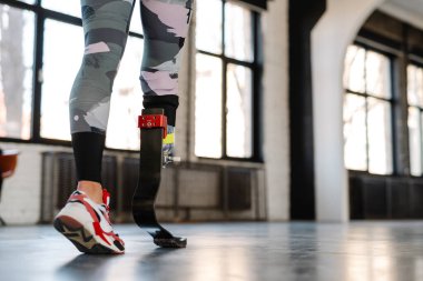 Protezli genç sporcu kadın içeride çalışıyor.