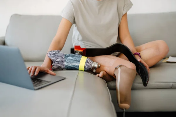 Rajattu Kuva Nuori Valkoinen Vammainen Nainen Proteettinen Jalka Istuu Sohvalla — kuvapankkivalokuva
