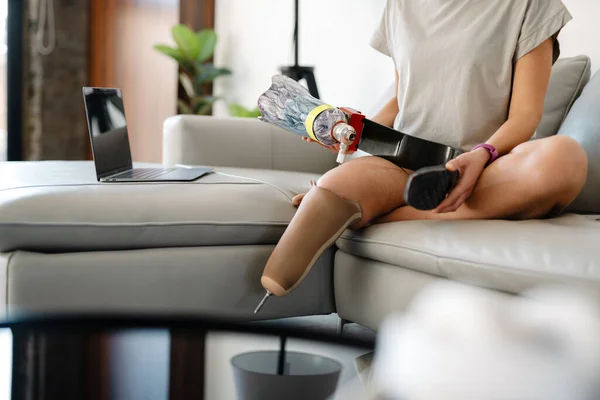Evde Dizüstü Bilgisayarla Kanepede Oturan Protez Bacaklı Engelli Genç Bir — Stok fotoğraf