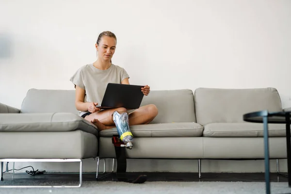 Genç Sakat Protez Bacaklı Bir Kadın Evdeki Dizüstü Bilgisayarla Kanepede — Stok fotoğraf