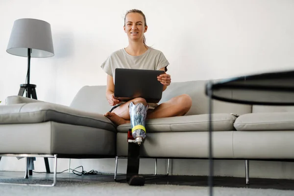 Gülümseyen Sakat Protez Bacaklı Bir Kadın Evinde Dizüstü Bilgisayarla Koltukta — Stok fotoğraf