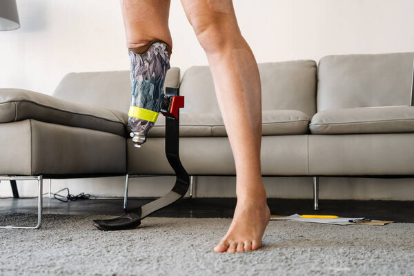 Крупным планом молодой женщины с протезной ногой, стоящей на ковре перед диваном дома