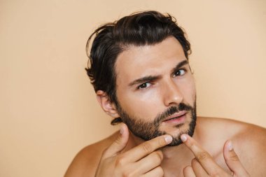 Yüzünde sivilce olan genç, yarı çıplak bir adam bej arka planda izole edilmiş.