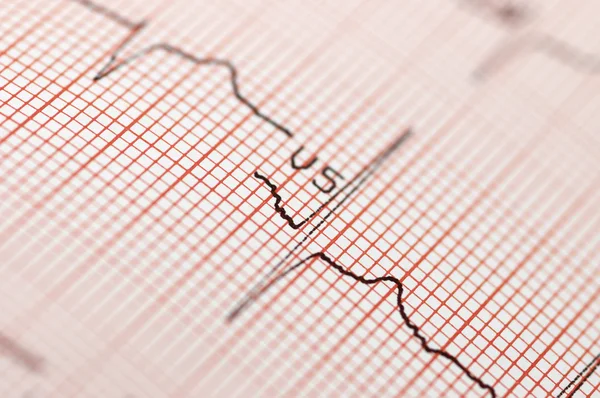 Cardiogram — Stock Photo, Image