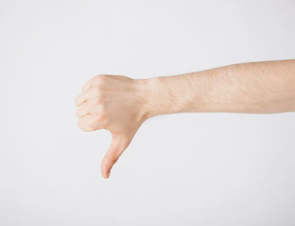 Homem mostrando polegares para baixo — Fotografia de Stock