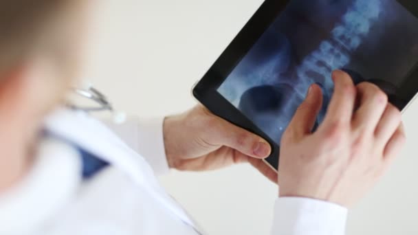 Professional doctor working with x-ray scan on tablet pc — Stock Video